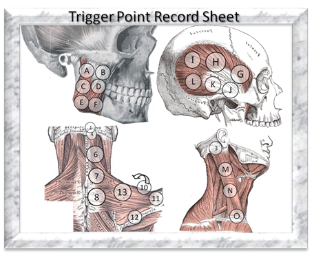 Trigger Point Record Sheet