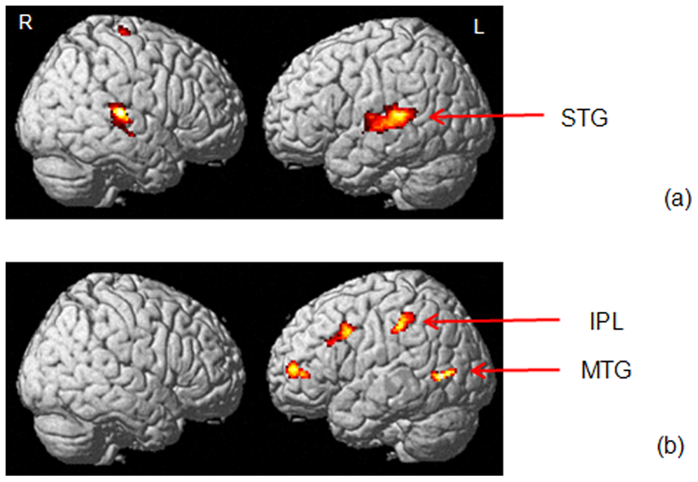 brain experiment for tinnitus